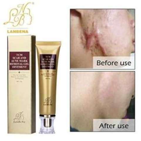 Deep scar and Acne mark removal Gel ointment