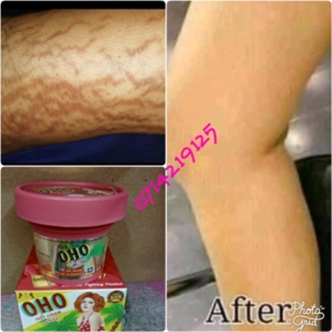 Oho stretch marks cream
