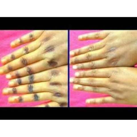 Dark Knuckles Remover Serum